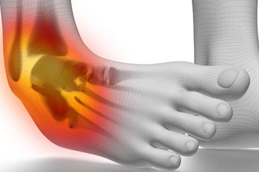 Image depicting treatment for Ankle Syndesmosis Ligament Injury at our Chandigarh-based physiotherapy clinic