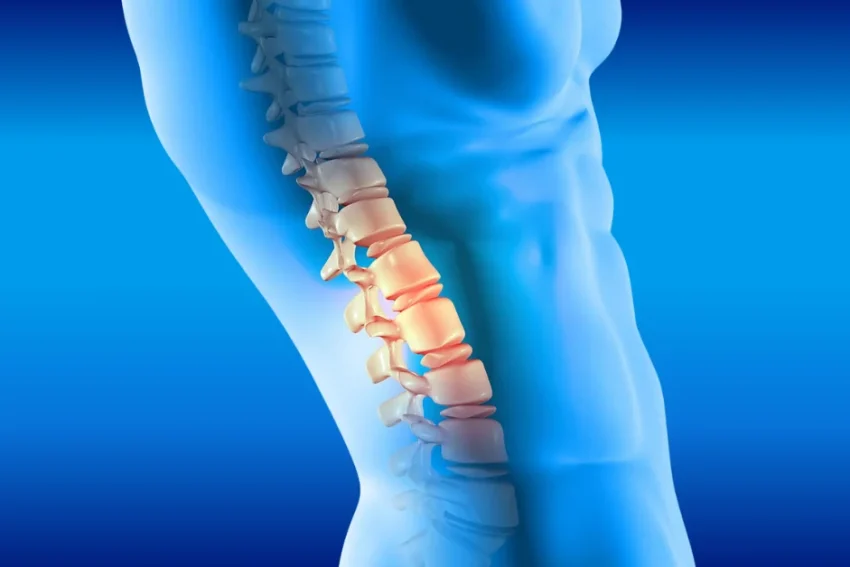 Image illustrating treatment for Degenerative Disc Disease at our Chandigarh-based physiotherapy clinic