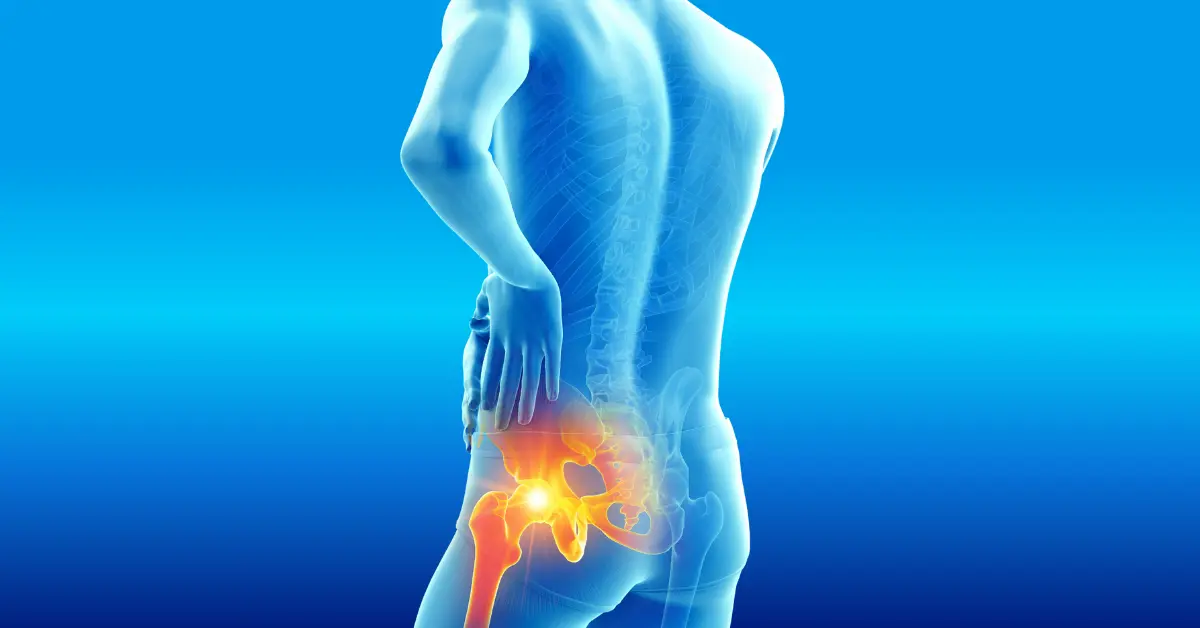 Piriformis Syndrome - Life Physiotherapy Clinic