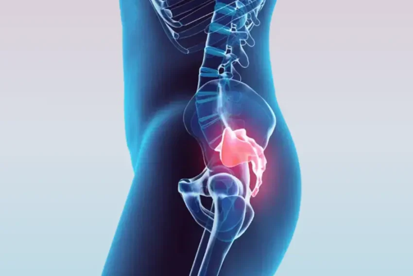 Image illustrating treatment for Tailbone Pain (Coccydynia) at our Chandigarh-based physiotherapy clinic