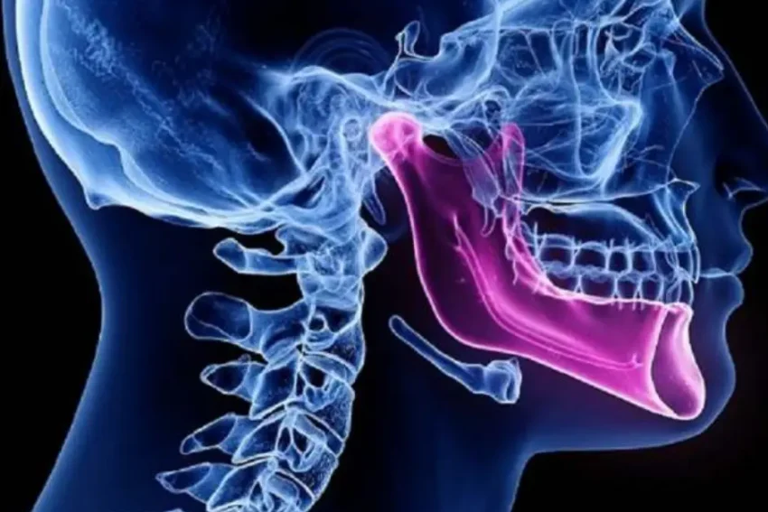 Image depicting treatment for Temporomandibular Joint (TMJ) at our Chandigarh-based physiotherapy clinic